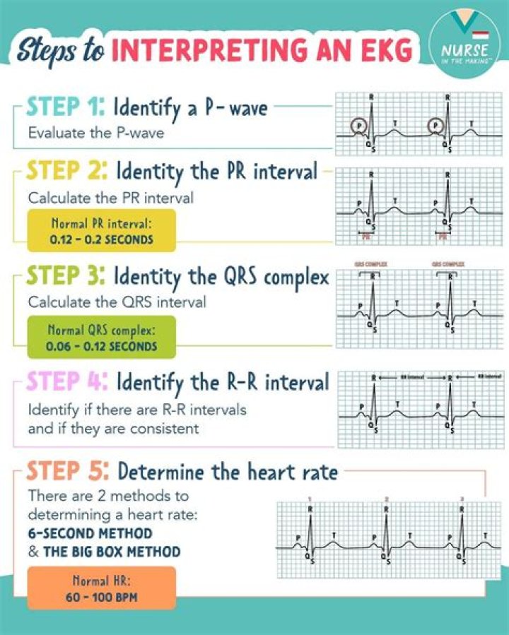 Understanding RR Normal Range: A Comprehensive Guide